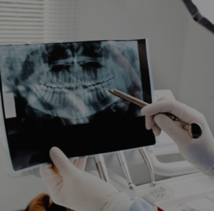 Endodontia