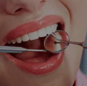 Estética dentária